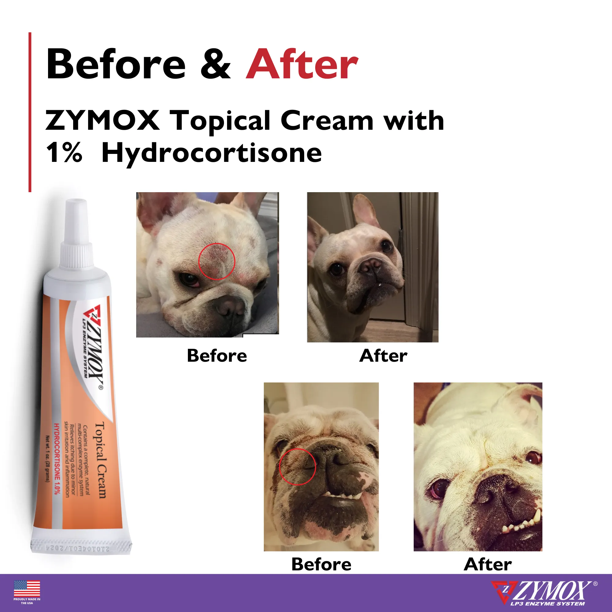 ZYMOX® Topical Cream with 1% Hydrocortisone